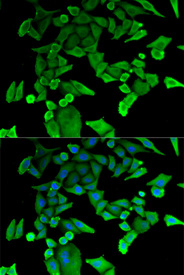 Immunofluorescence analysis of HeLa cell using TPT1 antibody. Blue: DAPI for nuclear staining.