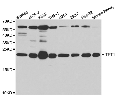 Western blot analysis of extracts of various cell lines, using TPT1 antibody.