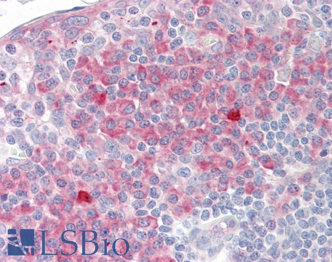 Anti-TCTP antibody IHC of human tonsil. Immunohistochemistry of formalin-fixed, paraffin-embedded tissue after heat-induced antigen retrieval. Antibody LS-B8403 dilution 5 ug/ml.