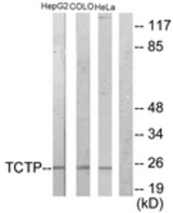 Western blot of extracts from HepG2/COLO205/HeLa cells, using TCTP Antibody. The lane on the right is treated with the synthesized peptide.