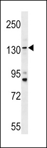 TMC5 Antibody western blot of HL-60 cell line lysates (35 ug/lane). The TMC5 antibody detected the TMC5 protein (arrow).