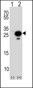 Western blot of TPT1 Antibody (arrow) using rabbit polyclonal TPT1 Antibody. 293 cell lysates (2 ug/lane) either nontransfected (Lane 1) or transiently transfected (Lane 2) with the TPT1 gene. A goat anti-rabbit IgG H&L (HRP) at 1:5000 dilution was used as the secondary antibody.