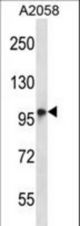 TMC6 Antibody western blot of A2058 cell line lysates (35 ug/lane). The TMC6 antibody detected the TMC6 protein (arrow).