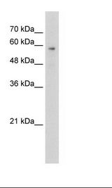 Jurkat Cell Lysate