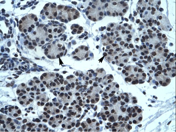 TPTE antibody LS-C30989 was used in IHC to stain formalin-fixed, paraffin-embedded human pancreas.