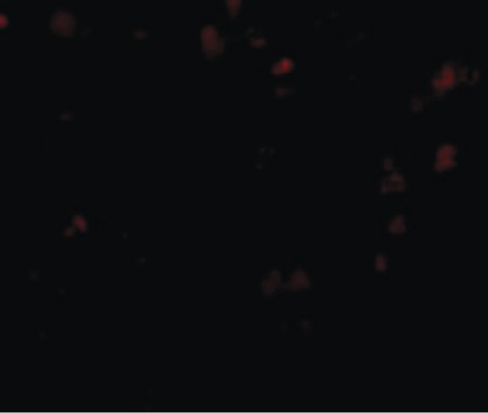 Immunofluorescence of EVER1 in Human Spleen cells with EVER1 antibody at 20 ug/ml.