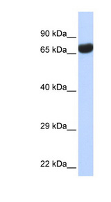 TPTE antibody LS-C110212 Western blot of Fetal lung lysate.