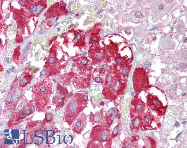 Anti-TPTE antibody IHC of human adrenal. Immunohistochemistry of formalin-fixed, paraffin-embedded tissue after heat-induced antigen retrieval. Antibody LS-B6467 concentration 2.5 ug/ml.