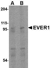 Western blot of EVER1 in human spleen tissue lysate with EVER1 antibody at (A) 1 and (B) 2 ug/ml.