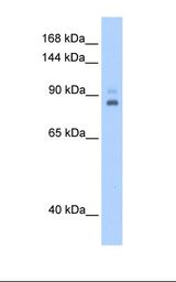 721_B cell lysate. Antibody concentration: 0.5 ug/ml. Gel concentration: 12%.