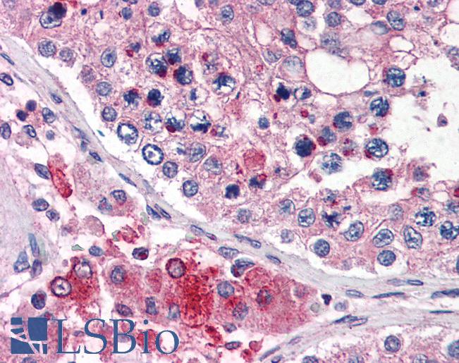 Anti-TMC6 antibody IHC of human testis. Immunohistochemistry of formalin-fixed, paraffin-embedded tissue after heat-induced antigen retrieval. Antibody LS-B2699 concentration 5 ug/ml.
