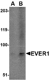 Western blot of EVER1 in A-20 cell lysate with EVER1 antibody at (A) 1 and (B) 2 ug/ml.