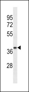 Western blot of lysate from human ovary tissue lysate, using TRA2A Antibody. Antibody was diluted at 1:1000 at each lane. A goat anti-rabbit IgG H&L (HRP) at 1:5000 dilution was used as the secondary antibody. Lysate at 35ug per lane.