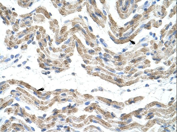TRA2B / SFRS10 antibody LS-C30698 was used in IHC to stain formalin-fixed, paraffin-embedded human muscle.