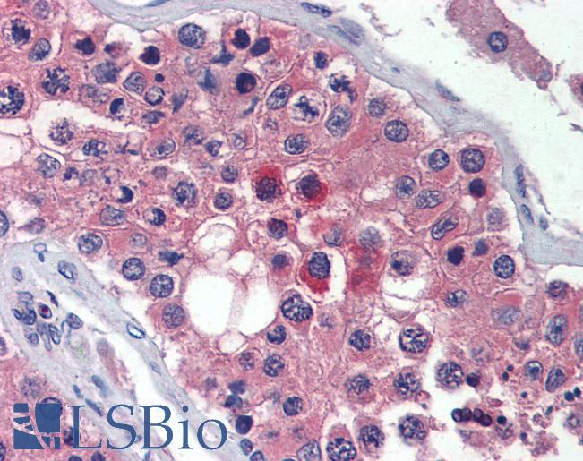 Anti-TMC8 / EVER2 antibody IHC of human testis. Immunohistochemistry of formalin-fixed, paraffin-embedded tissue after heat-induced antigen retrieval. Antibody LS-B3804 concentration 5 ug/ml.