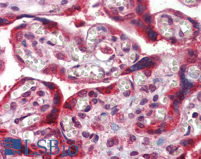 Anti-TMC8 / EVER2 antibody IHC of human placenta. Immunohistochemistry of formalin-fixed, paraffin-embedded tissue after heat-induced antigen retrieval. Antibody LS-B3804 concentration 5 ug/ml.