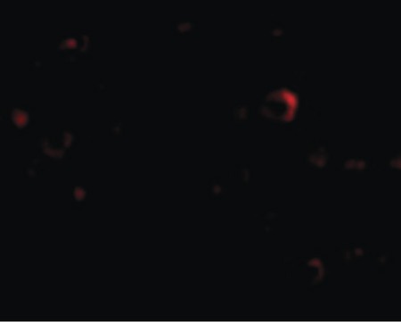 Immunofluorescence of EVER2 in Human Brain cells with EVER2 antibody at 20 ug/ml.