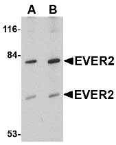 Western blot of EVER2 in Jurkat cell lysate with EVER2 antibody at (A) 1 and (B) 2 ug/ml.