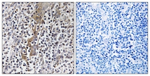 IHC of paraffin-embedded human tonsil, using TMC8 Antibody. The sample on the right was incubated with synthetic peptide.