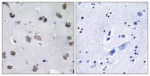 IHC of paraffin-embedded human brain tissue, using MIPT3 Antibody. The picture on the right is treated with the synthesized peptide.