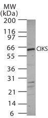 Western blot of CIKS using antibody on 15 ugs of mouse kidney cell lysate.