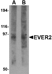 Western blot of EVER2 in rat thymus tissue lysate with EVER2 antibody at (A) 1 and (B) 2 ug/ml.