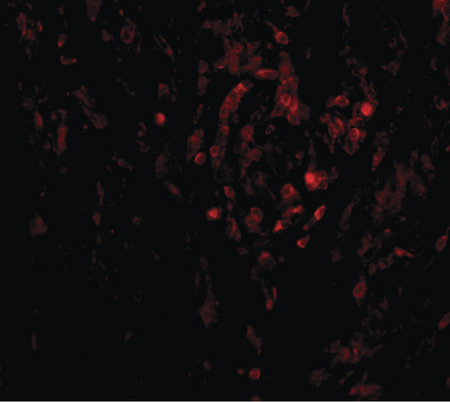 Immunofluorescence of CIKS in human lung tissue with CIKS antibody at 20 ug/ml.