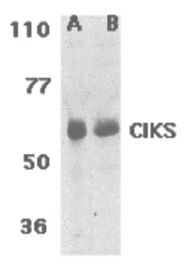 Western blot of CIKS expression in human lung (lane A) and placenta (lane B) tissue lysates with CIKS antibody at 1 ug /ml.