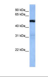 Jurkat cell lysate. Antibody concentration: 1.0 ug/ml. Gel concentration: 12%.
