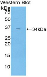 Western blot of recombinant TRAF5.