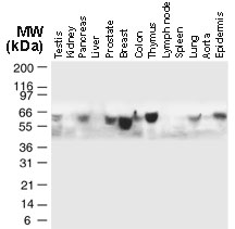 Western blot of TRAF5 in normal human tissues using LS-C148302 at 1:2000. TRAF5 is observed at ~64 kD. Additional bands of lower molecular weight were seen in some cases, and may represent TRAF5 degradation fragments