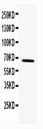 WB of TRAF5 antibody. WB: k562 Cell Lysate.