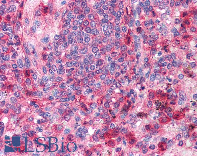 Anti-TRAF6 antibody IHC of human spleen. Immunohistochemistry of formalin-fixed, paraffin-embedded tissue after heat-induced antigen retrieval. Antibody LS-B207 concentration 5 ug/ml.