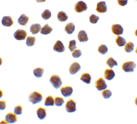 Immunocytochemistry of TRAF6 in K562 cells with TRAF6 antibody at 0.5 ug/ml.