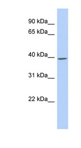 TMCC1 antibody LS-C110977 Western blot of COLO205 cell lysate.