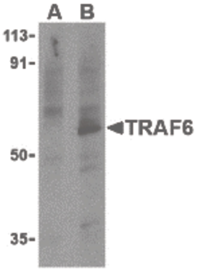 Western blot of TRAF6 in PC-3 cell lysates with TRAF6 antibody at 1 ug/ml in the presence (A) or absence (B) of 1 ug blocking peptide.