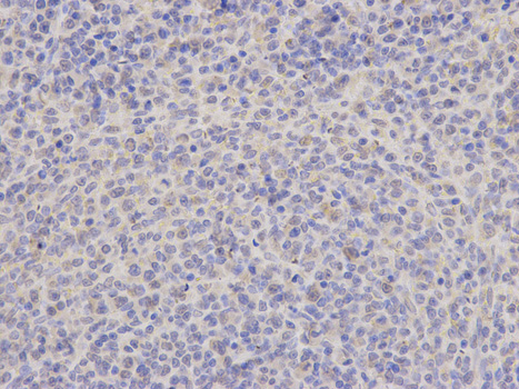Immunohistochemistry of paraffin-embedded rat spleen using TRAF6 antibody at dilution of 1:200 (400x lens).