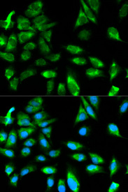Immunofluorescence analysis of HeLa cell using TRAF6 antibody. Blue: DAPI for nuclear staining.