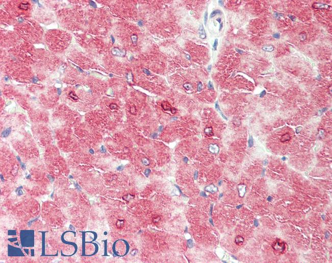 Mouse Heart: Formalin-Fixed, Paraffin-Embedded (FFPE)