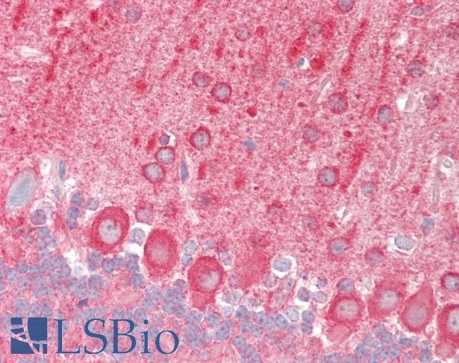 Mouse Brain, Cerebellum: Formalin-Fixed, Paraffin-Embedded (FFPE)