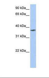 Fetal muscle lysate. Antibody concentration: 1.0 ug/ml. Gel concentration: 12%.