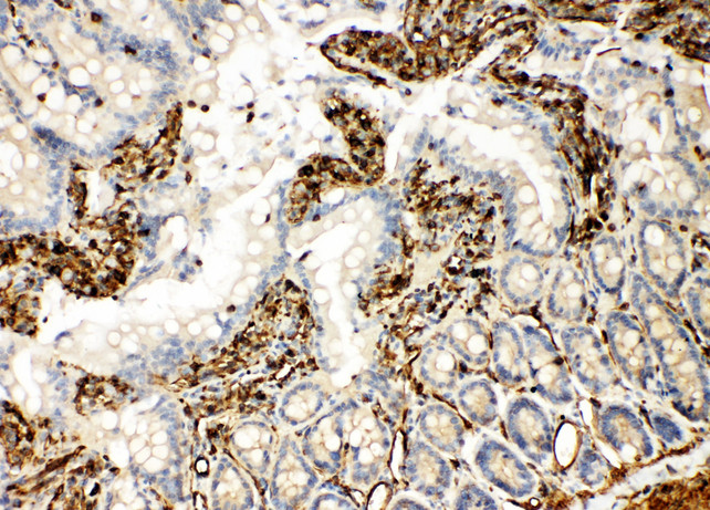 TRAF6 antibody. IHC(P): Rat Intestine Tissue.