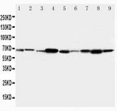 WB of TRAF6 antibody. Lane 1: Rat Heart Tissue Lysate. Lane 2: Rat Brain Tissue Lysate. Lane 3: Human Placenta Tissue Lysate. Lane 4: Rat Lung Tissue Lysate. Lane 5: PANC Cell Lysate. Lane 6: HELA Cell Lysate. Lane 7: SMMC Cell Lysate. Lane 8: A549 Cell Lysate. Lane 9: MCF-7 Cell Lysate.