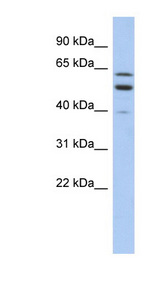 TMCC1 antibody LS-C110978 Western blot of PANC1 cell lysate.