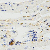 Immunohistochemistry of paraffin-embedded rat heart tissue using TRAF7 antibody at dilution of 1:200 (x400 lens)