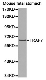Western blot analysis of extracts of mouse fetal stomach cell line, using TRAF7 antibody.
