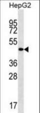 TMCC3 Antibody western blot of HepG2 cell line lysates (35 ug/lane). The TMCC3 antibody detected the TMCC3 protein (arrow).