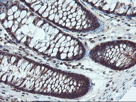 IHC of paraffin-embedded Human colon tissue using anti-TRAIP mouse monoclonal antibody. (Heat-induced epitope retrieval by 10mM citric buffer, pH6.0, 100C for 10min).