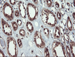 IHC of paraffin-embedded Human Kidney tissue using anti-TRAIP mouse monoclonal antibody. (Heat-induced epitope retrieval by 10mM citric buffer, pH6.0, 100C for 10min).