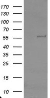 HEK293T cells were transfected with the pCMV6-ENTRY control (Left lane) or pCMV6-ENTRY TRAIP (Right lane) cDNA for 48 hrs and lysed. Equivalent amounts of cell lysates (5 ug per lane) were separated by SDS-PAGE and immunoblotted with anti-TRAIP.